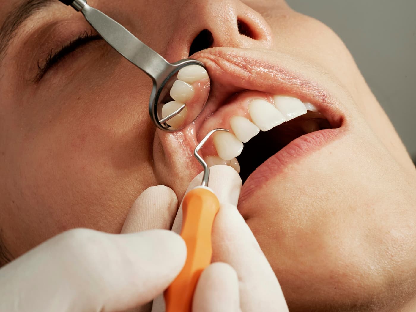 Revisión de la sonrisa de una paciente con espejo dental
